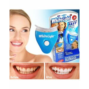 Συσκευή Λεύκανσης Δοντιών WHITE LIGHT