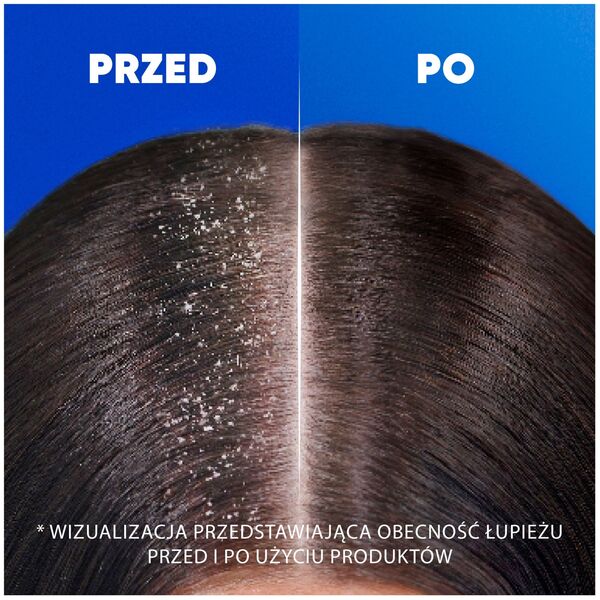 Σαμπουάν Head&Shoulders Apple Fresh, 800 ml