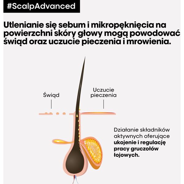L'Oreal Professionnel, Serie Expert Scalp Advanced, Hair Leave-In Cream Treatment, Anti-Discomfort, 200 ml For Women
