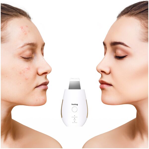 Huslog skin purifier BE-100224